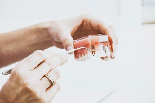 Get in the Know with Different Types of Dental Implants