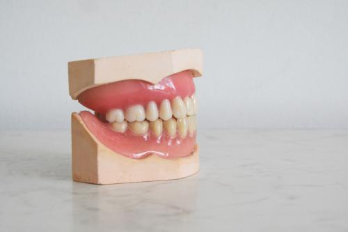 Complete Guide to Overdentures