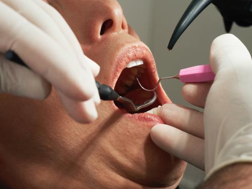 The Ultimate Guide to Understanding All Types of Dental Surgery