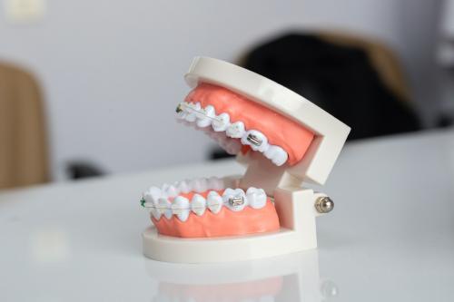 Tips on Braces Care