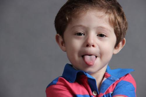 What is a Frenectomy? Treating Tongue and Lip Ties