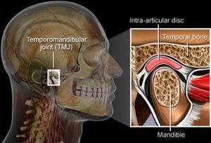 Temporomandibular Joint Disorder | Kneib Dentistry in Erie, PA