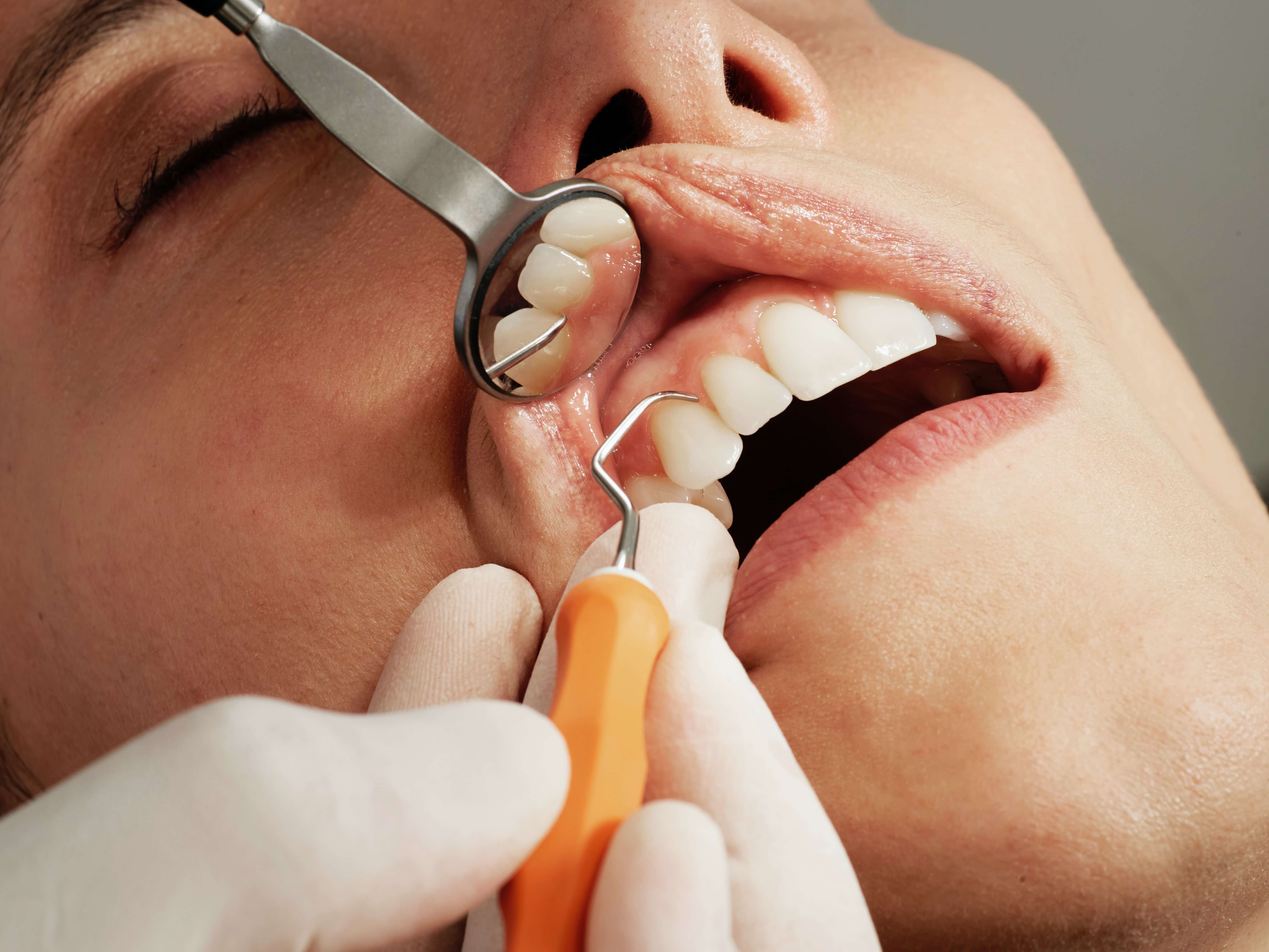 dental treatments