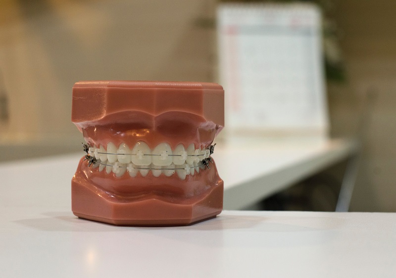 Orthodontic Services in Erie, PA | Kneib Dentistry